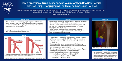 Preview of Three-dimensional Tissue Rendering And Volume Analysis Of A Novel Medial Thigh Flap Using CT Angiography: The Chimeric Gracilis And PAP Flap