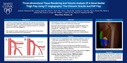 Thumbnail for Three-dimensional Tissue Rendering And Volume Analysis Of A Novel Medial Thigh Flap Using CT Angiography: The Chimeric Gracilis And PAP Flap