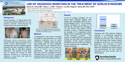Thumbnail for Use of Hedgehog Inhibitors in the Treatment of Gorlin Syndrome
