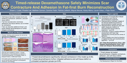Thumbnail for Timed-release Dexamethasone Safely Minimizes Scar Contracture And Adhesion In Fat-first Burn Reconstruction