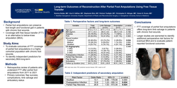 Thumbnail for Long-term Outcomes Of Reconstruction After Partial Foot Amputations Using Free Tissue Transfer