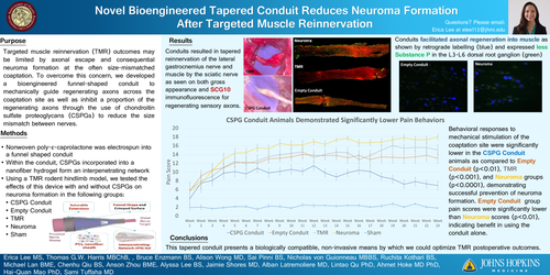 Preview of A Novel Bioengineered Conduit Reduces Neuroma Formation After Targeted Muscle Reinnervation