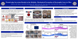Thumbnail for Wound-edge Inversion Results In The Reliable, Mechanical Formation Of Dystrophic Scars In Mice