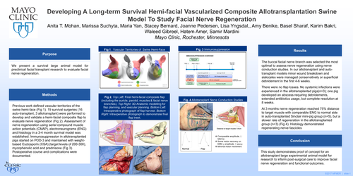 Preview of Developing A Long-term Survival Hemi-facial Vascularized Composite Allotransplantation Swine Model To Study Facial Nerve Regeneration