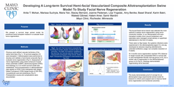 Thumbnail for Developing A Long-term Survival  Hemi-facial Vascularized Composite Allotransplantation Swine Model To Study Facial Nerve Regeneration
