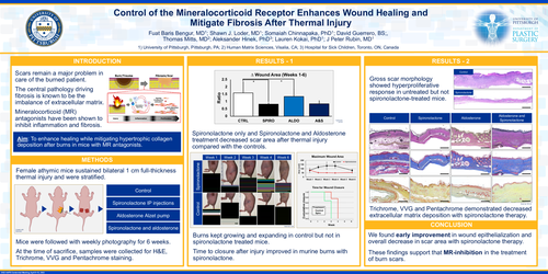 Preview of Control Of The Mineralocorticoid Receptor Enhances Wound Healing And Mitigate Fibrosis After Thermal Injury.