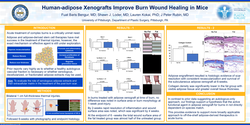 Thumbnail for Human-adipose Xenografts Improve Burn Wound Healing In Mice