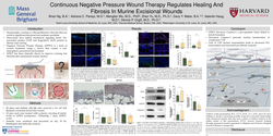 Thumbnail for Continuous Negative Pressure Wound Therapy Regulates Healing And Fibrosis In Murine Excisional Wounds