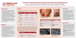 Thumbnail for Pregnancy Associated Breast Changes After Nipple Sparing Mastectomy