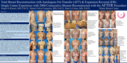 Thumbnail for Total Breast Reconstruction With Reverse Expansion (RE) And Autologous Fat Transfer (AFT): Single Center Experience With 2000 Breasts