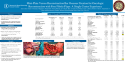 Thumbnail for Mini-Plate Versus Reconstruction Bar Fixation For Oncologic Reconstruction With Free Fibula Flaps: A Single Center Experience
