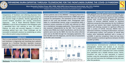 Thumbnail for Expanding Burn Expertise Through Telemedicine For The Frontliners During The Covid-19 Pandemic