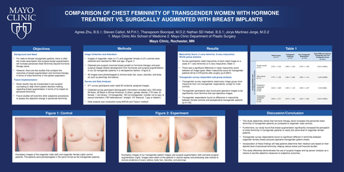 Preview of Comparison Of Chest Femininity Of Transgender Women With Hormone Treatment Vs. Surgically Augmented With Breast Implants