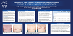 Thumbnail for Comparison Of Chest Femininity Of Transgender Women With Hormone Treatment Vs. Surgically Augmented With Breast Implants