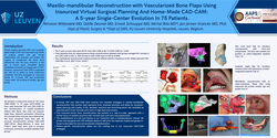 Preview of Maxillo-mandibular Reconstruction With Vascularized Bone Flaps Using Insourced Virtual Surgical Planning And Home-made Cad-cam: A 5-year Single-center Evolution In 75 Patients.