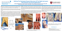 Thumbnail for Defining The Histological Support Structures Of The Digital Webspace: New Anatomy And Clinical Applications.