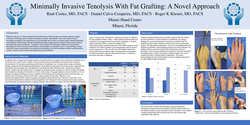 Thumbnail for Minimally Invasive Tenolysis With Fat Grafting: A Novel Approach
