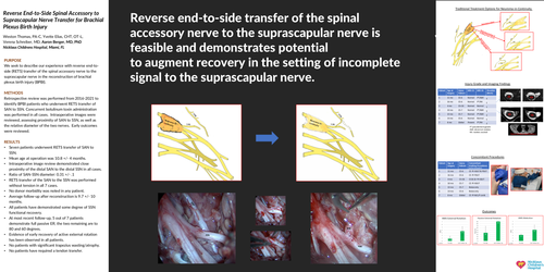 Preview of Reverse End-to-side Spinal Accessory To Suprascapular Supercharge Nerve Transfer For Brachial Plexus Birth Injury