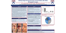 Thumbnail for Utilizing Integra For Reconstruction Of Facial Defects After Mohs Micrographic Surgery