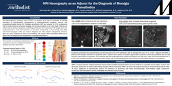 Thumbnail for MRI Neurography As An Adjunct For The Diagnosis Of Meralgia Paresthetica