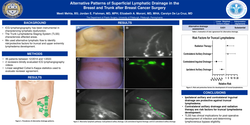 Thumbnail for Alternative Patterns Of Superficial Lymphatic Drainage In The Breast And Trunk After Breast Cancer Surgery