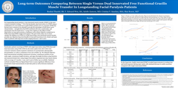 Thumbnail for Long-term Outcomes Comparing Between Single Versus Dual Innervated Free Functional Gracilis Muscle Transfer In Longstanding Facial Paralysis Patients