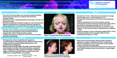 Preview of A Comparative Photogrammetric Assessment Of Soft Tissue Changes Following LeFort III And Monobloc Midface Advancement