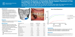 Thumbnail for Long-term Clinical Outcomes Following Free Fibula Flap Head And Neck Reconstruction With Immediate Dental Implant Placement