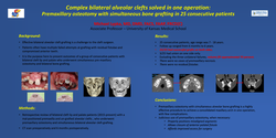 Thumbnail for Complex Bilateral Alveolar Clefts Solved In One Operation: Premaxillary Osteotomy With Simultaneous Bone Grafting In 25 Consecutive Patients
