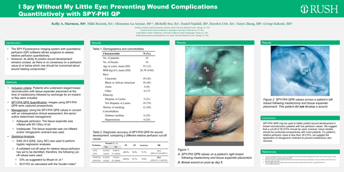 Preview of Use Of Spy-QPTo Predict Mastectomy Skin Flap Wound Complications In Immediate Breast Reconstruction
