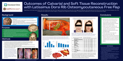 Thumbnail for Outcomes Of Calvarial And Soft Tissue Reconstruction With Latissimus Dorsi Rib Osteomyocutaneous Free Flap