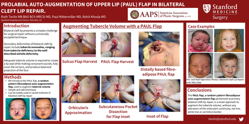 Preview of Prolabial Augmentation Of Upper Lip (PAUL) Turnover Flap In Bilateral Cleft Lip Repair.