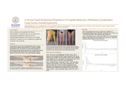 Thumbnail for A 28-year Single Institutional Experience Of Complete Reduction Of Extremity Lymphedema Using Suction Assisted Lipectomy