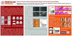 Thumbnail for A Novel “Smooth” Breast Implant Surface Design That Provides Implant Stability