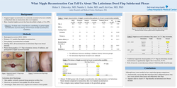 Thumbnail for What Nipple Reconstruction Can Tell Us About The Latissimus Dorsi Flap Subdermal Plexus