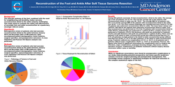 Thumbnail for Reconstruction Distal To Ankle After Soft Tissue Sarcoma Resection