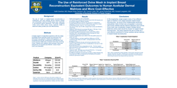 Thumbnail for Selecting An Acellular Dermal Matrix For Breast Reconstruction: A Comparative Analysis Of Complication Rates In Various Adms