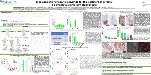 Preview of Mixed Metal Oxide Nanoparticles For Seroma Treatment: A Comparative Long-term Study In Rats