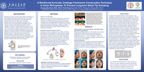Preview of A Reinforced Auricular Cartilage Framework Construction Technique In Asian Rhinoplasty To Prevent Long-term Nasal Tip Drooping