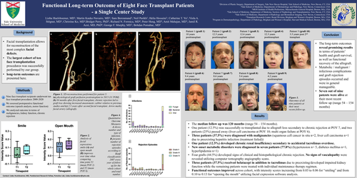 Preview of Functional Long-term Outcome Of Eight Face Transplant Patients - A Single Center Study
