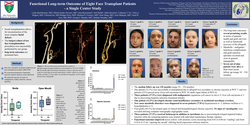 Preview of Functional Long-term Outcome Of Eight Face Transplant Patients - A Single Center Study