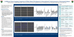 Thumbnail for A Diffusion Tensor Imaging Comparison Of White Matter Development In Nonsyndromic Craniosynostosis To Neurotypical Infants