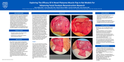 Thumbnail for Exploring The Efficacy Of A Novel Platysma Muscle Flap In Rat Models For Advancing Facial Paralysis Reconstruction Research