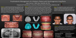 Thumbnail for Prosthodontic Management of a Pediatric Patient with Severe Dentinogenesis Imperfecta 