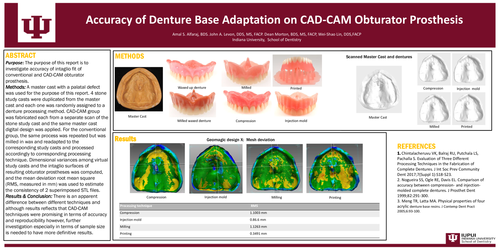 Preview of Accuracy of Denture Base Adaptation on CAD-CAM Obturator Prosthesis