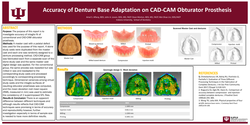 Thumbnail for Accuracy of Denture Base Adaptation on CAD-CAM Obturator Prosthesis