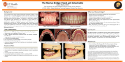 Thumbnail for The Marius Bridge: Fixed, yet Detachable