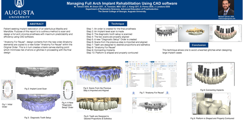 Preview of Managing Full Arch Implant Rehabilitation Using CAD Software