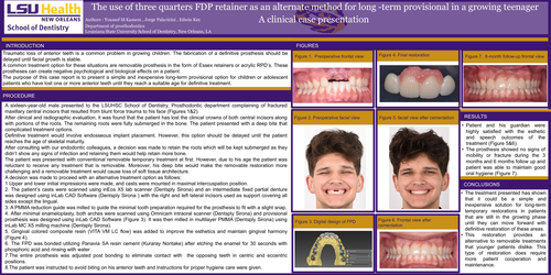 Preview of The use of three quarters restoration for FDP as an alternate method for long-term provisional in a growing teenager. A clinical case presentation.