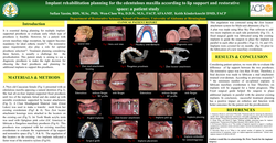 Thumbnail for Implant rehabilitation planning for edentulous maxilla according to lip support and restorative space: a case report.